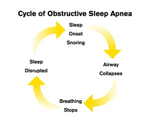 Sleep Apnea: Common Sleep Disorders